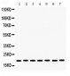 Anti-Lysozyme Picoband Antibody